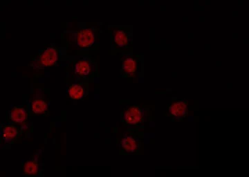 ICC/IF analysis of PFA-fixed COS7 cells using GTX01072 XRN2 Antibody. Permeabilization : 0.1% Triton X-100 Dilution : 1:200 ICC/IF analysis of PFA-fixed COS7 cells using GTX01072 XRN2 Antibody. Permeabilization : 0.1% Triton X-100 Dilution : 1:200