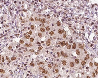 IHC-P analysis of human liver tissue section using GTX01072 XRN2 Antibody.<br>Antigen retrieval : Heat mediated antigen retrieval step in citrate buffer was performed<br>Dilution : 1:100