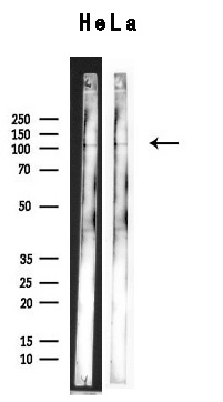 WB analysis of HeLa cell lysate using GTX01072 XRN2 Antibody.