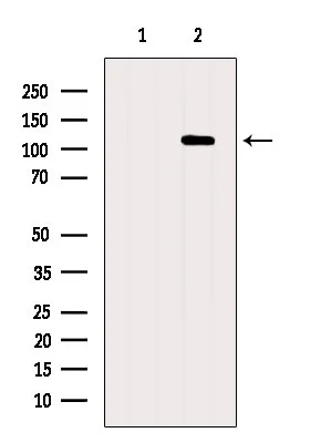 WB analysis of HeLa cell lysate using GTX01072 XRN2 Antibody. The lane on the left was treated with blocking peptide.