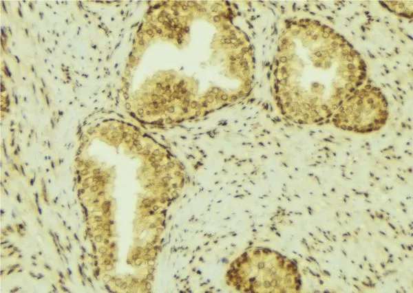 IHC-P analysis of mouse colon tissue using GTX01078 LCN2 antibody.<br>Antigen retrieval : Heat mediated antigen retrieval step in citrate buffer was performed<br>Dilution : 1:100