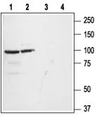 WB analysis of rat (lanes 1 and 3) and mouse (lanes 2 and 4) brain tissue lysates using GTX01081 GluR1 antibody.<br>Lane 1, 2 : Primary antibody<br>Lane 3, 4 : Primary antibody preincubated with the control peptide antigen<br>Dilution : 1:200