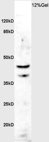 WB analysis of rat brain tissue lysate using GTX01086 ASMT antibody.<br>Dilution : 1:200
