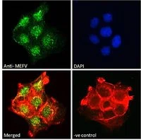 ICC/IF analysis of PFA-fixed A431 cells using GTX01092 MEFV antibody. Green : Primary antibody Red : Actin Blue : DAPI Permeabilization : 0.15% Triton X-100 Dilution : 10microg/ml
