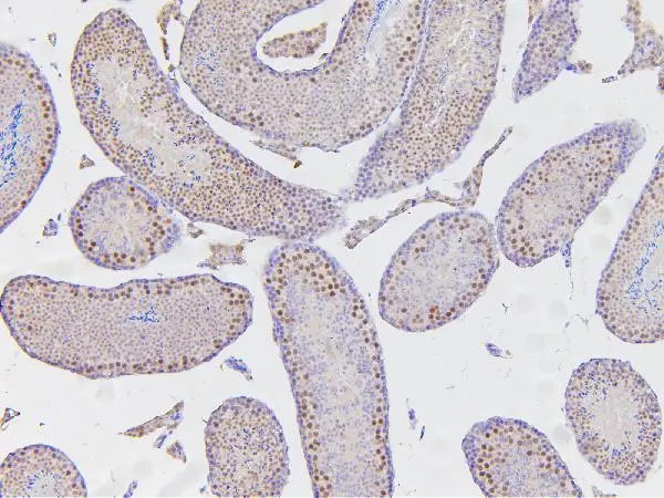 IHC-P analysis of mouse testis tissue using GTX01135 ARID2 antibody.<br>Antigen retrieval : Heat mediated antigen retrieval was performed in citrate buffer (pH6, epitope retrieval solution) for 20 mins<br>Dilution : 1?g/ml