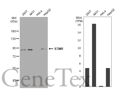 Various whole cell extracts (30 microg) were separated by 7.5% SDS-PAGE, and the membrane was blotted with STIM1 antibody [SD0814] (GTX01149) diluted at 1:500. The HRP-conjugated anti-rabbit IgG antibody (GTX213110-01) was used to detect the primary antibody. Corresponding RNA expression data for the same cell lines are based on Human Protein Atlas program.