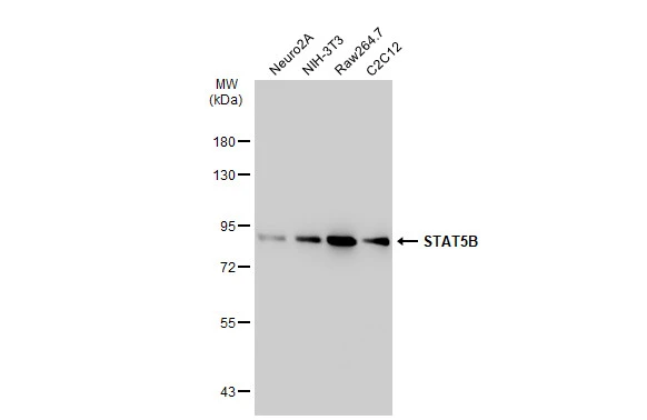 Various whole cell extracts (30 microg) were separated by 7.5% SDS-PAGE, and the membrane was blotted with STAT5B antibody [SD08-08] (GTX01153) diluted at 1:1000. The HRP-conjugated anti-rabbit IgG antibody (GTX213110-01) was used to detect the primary antibody.