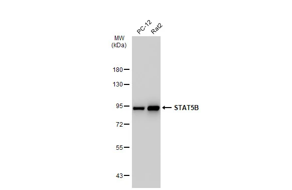 Various whole cell extracts (30 microg) were separated by 7.5% SDS-PAGE, and the membrane was blotted with STAT5B antibody [SD08-08] (GTX01153) diluted at 1:1000. The HRP-conjugated anti-rabbit IgG antibody (GTX213110-01) was used to detect the primary antibody.