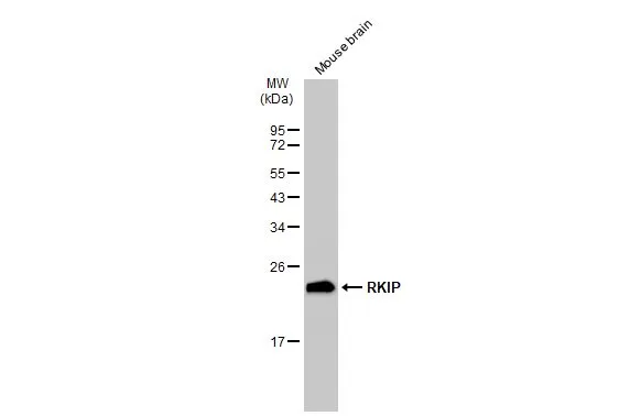 Mouse tissue extract (50 microg) was separated by 12% SDS-PAGE, and the membrane was blotted with RKIP antibody [SC58-09] (GTX01163) diluted at 1:500. The HRP-conjugated anti-rabbit IgG antibody (GTX213110-01) was used to detect the primary antibody.