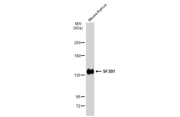 Mouse tissue extract (50 microg) was separated by 5% SDS-PAGE, and the membrane was blotted with SF3B1 antibody [JB40-32] (GTX01165) diluted at 1:1000. The HRP-conjugated anti-rabbit IgG antibody (GTX213110-01) was used to detect the primary antibody.