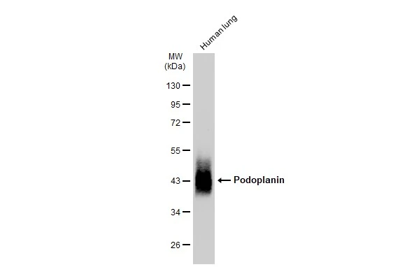 Human tissue extract (30 microg) was separated by 10% SDS-PAGE, and the membrane was blotted with Podoplanin antibody [JM31-21] (GTX01168) diluted at 1:500. The HRP-conjugated anti-rabbit IgG antibody (GTX213110-01) was used to detect the primary antibody.