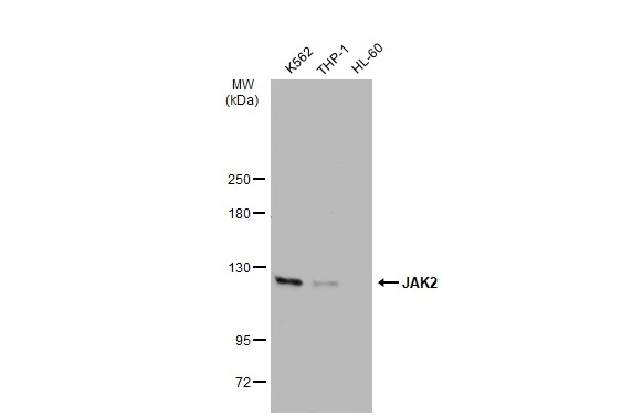 Various whole cell extracts (30 ?g) were separated by 5% SDS-PAGE, and the membrane was blotted with JAK2 antibody [GT1214] (GTX01195) diluted at 1:500. The HRP-conjugated anti-rabbit IgG antibody (GTX213110-01) was used to detect the primary antibody.