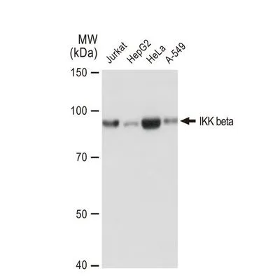 WB analysis of various samples using GTX01197 IKK beta antibody [GT1216].<br>Dilution : 1:1000<br>Loading : 25?g