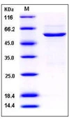 SDS-PAGE of 5 ?g GTX01205-pro Human CDK4 protein, GST tag (active).