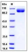 SDS-PAGE of 5 ?g GTX01209-pro Human BCHE protein, His tag (active).