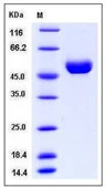 SDS-PAGE of 5 ?g GTX01210-pro Human Cathepsin D protein, His tag (active).