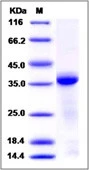 SDS-PAGE of 5 ?g GTX01211-pro Human Cathepsin L protein, His tag (active).
