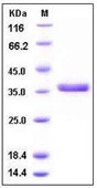 SDS-PAGE of 5 ?g GTX01212-pro Human Cathepsin S protein, His tag (active).