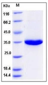 SDS-PAGE of 5 ?g GTX01214-pro Human PSA protein, His tag (active).