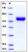 SDS-PAGE of 5 ?g GTX01217-pro Human MMP1 protein, His tag (active).