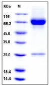 SDS-PAGE of 5 ?g GTX01218-pro Human MMP8 protein, His tag (active).