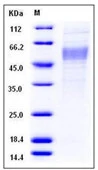 SDS-PAGE of 5 ?g GTX01219-pro Human PLA2G7 protein, His tag (active).