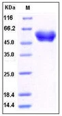 SDS-PAGE of 5 ?g GTX01220-pro Human alpha 1 Antitrypsin protein, His tag (active).