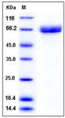SDS-PAGE of 5 ?g GTX01226-pro Mouse AChE protein, His tag (active).