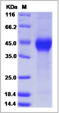 SDS-PAGE of 5 ?g GTX01227-pro Mouse DKK1 protein, His tag (active).