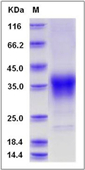 SDS-PAGE of 5 ?g GTX01230-pro Mouse EPO protein, His tag (active).