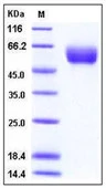 SDS-PAGE of 5 ?g GTX01232-pro Human Angiotensinogen protein, His tag (active).