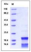 SDS-PAGE of 5 ?g GTX01233-pro Human Caspase 7 protein, His tag.