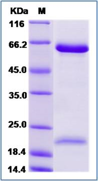 SDS-PAGE of 5 ?g GTX01241-pro Human PCSK9 protein, His tag (active).