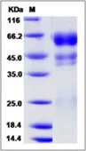 SDS-PAGE of 5 ?g GTX01244-pro Human Protein C protein, His tag.