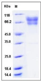 SDS-PAGE of 5 ?g GTX01255-pro Human Factor IX protein, His tag (active).