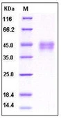 SDS-PAGE of 5 ?g GTX01256-pro Human DKK1 protein, His tag (active).