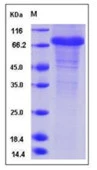 SDS-PAGE of 5 ?g GTX01259-pro Human Follistatin protein, human IgG1 Fc tag (active).