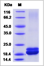 SDS-PAGE of 5 ?g GTX01263-pro Human Interferon alpha 1 protein, His tag (active).