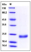 SDS-PAGE of 5 ?g GTX01265-pro Human IL28B protein, His tag (active).
