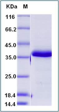 SDS-PAGE of 5 ?g GTX01268-pro Human IGFBP5 protein, His tag (active).
