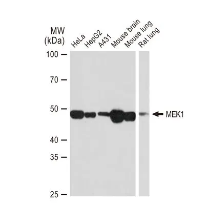 WB analysis of various samples using GTX01293 MEK1 antibody [GT1158].<br>Dilution : 1:1000<br>Loading : 25 ?g