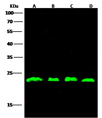 WB analysis of various samples using GTX01401 RhoA antibody.<br>Lane A : HL60 whole cell lysate<br>Lane B : MCF-7 whole cell lysate<br>Lane C : HeLa whole cell lysate<br>Lane D : SKBR3 whole cell lysate<br>Dilution : 1:500<br>Loading : 30 ?g