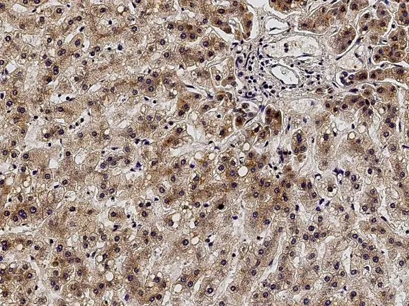 IHC-P analysis of human liver tissue section using GTX01413 ACVRL1 antibody.<br>Dilution : 1:5000