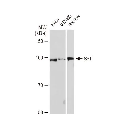 WB analysis of various samples using GTX01528 SP1 antibody [GT1220].<br>Dilution : 1:1000<br>Loading : 25 ?g