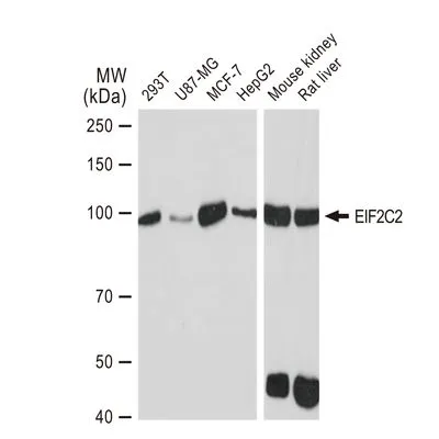 WB analysis of various samples using GTX01534 EIF2C2 antibody [GT1226].<br>Dilution : 1:1000<br>Loading : 25 ?g