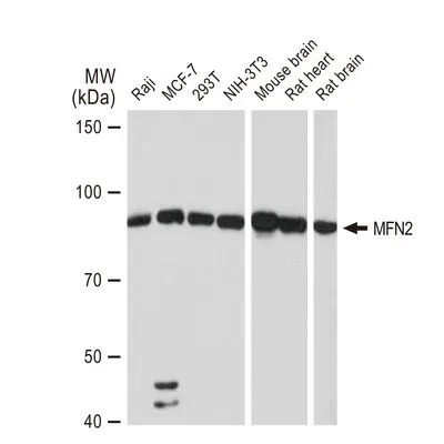 WB analysis of various samples using GTX01539 MFN2 antibody [GT1231].<br>Dilution : 1:1000<br>Loading : 25 ?g