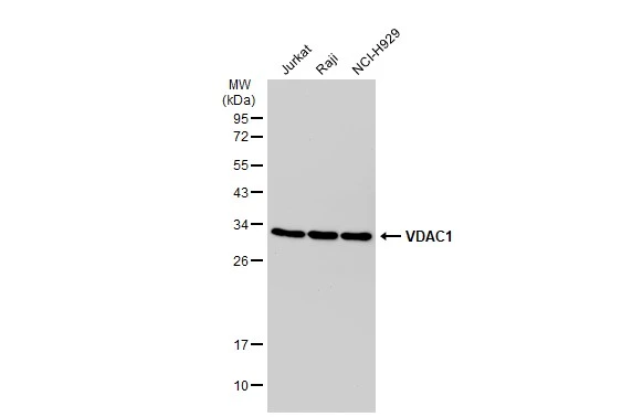 Various whole cell extracts (30 ?g) were separated by 12% SDS-PAGE, and the membrane was blotted with VDAC1 antibody [GT1235] (GTX01543) diluted at 1:1000. The HRP-conjugated anti-rabbit IgG antibody (GTX213110-01) was used to detect the primary antibody.