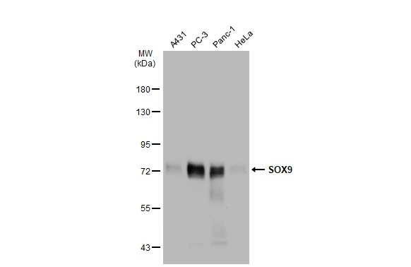 Various whole cell extracts (30 ?g) were separated by 7.5% SDS-PAGE, and the membrane was blotted with SOX9 antibody [GT1219] (GTX01545) diluted at 1:1000. The HRP-conjugated anti-FALSE was used to detect the primary antibody.