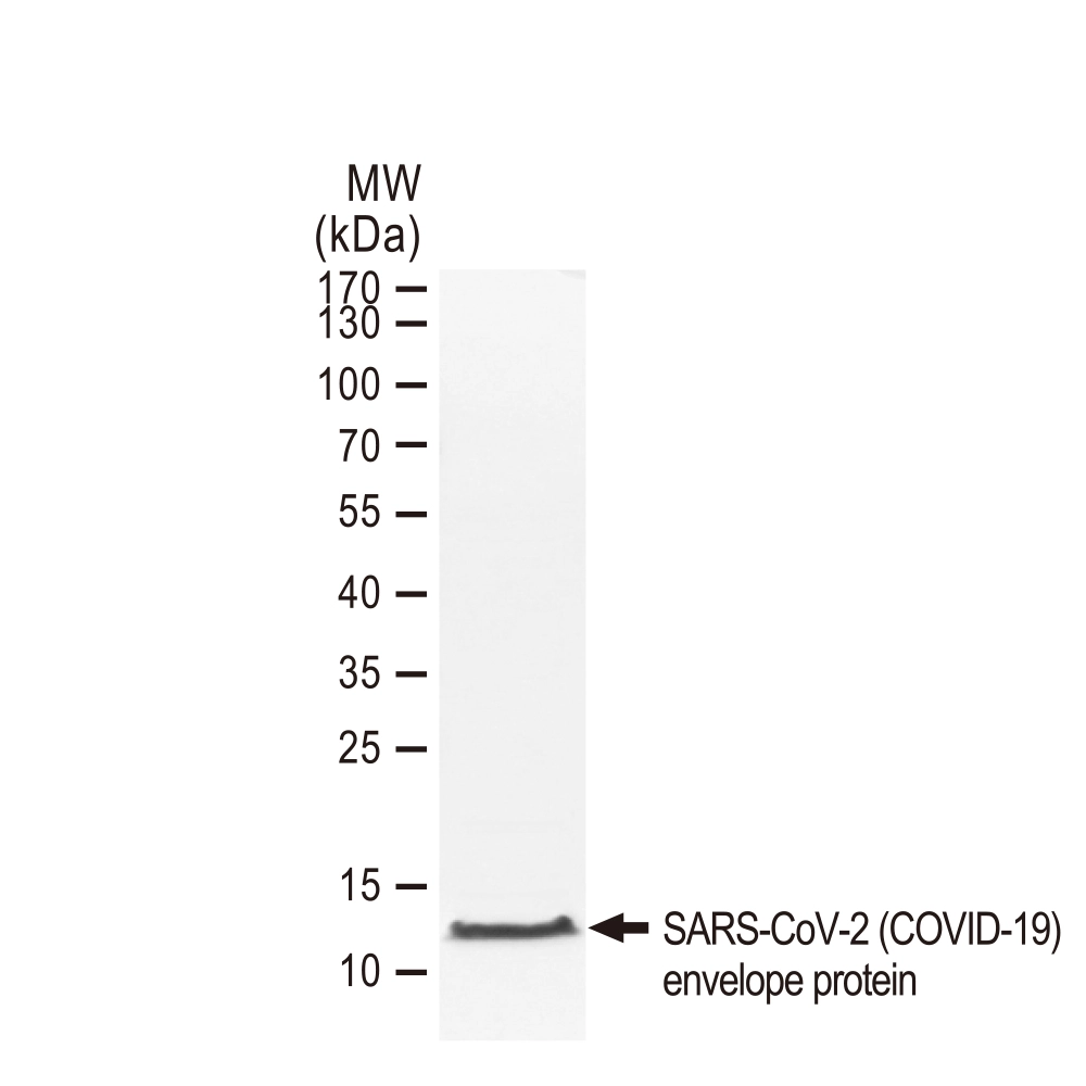 SDS-PAGE of GTX01547-pro SARS-CoV-2 (COVID-19) Envelope protein