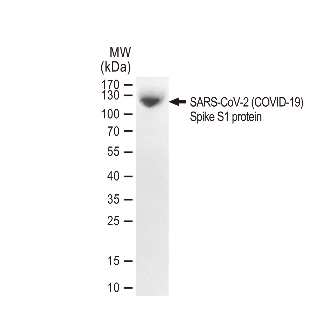 SDS-PAGE of GTX01548-pro SARS-CoV-2 (COVID-19) Spike S1 protein (active).